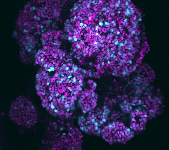 Mikroskopische Aufnahme des Organoids der Bauchspeicheldrüse. Das Magenta zeigt die Zellkerne, und das Cyan hebt die Azinuszellen hervor, die Verdauungsenzyme absondern. Kredit Amanda Andersson Rolf und Kelvin Groot