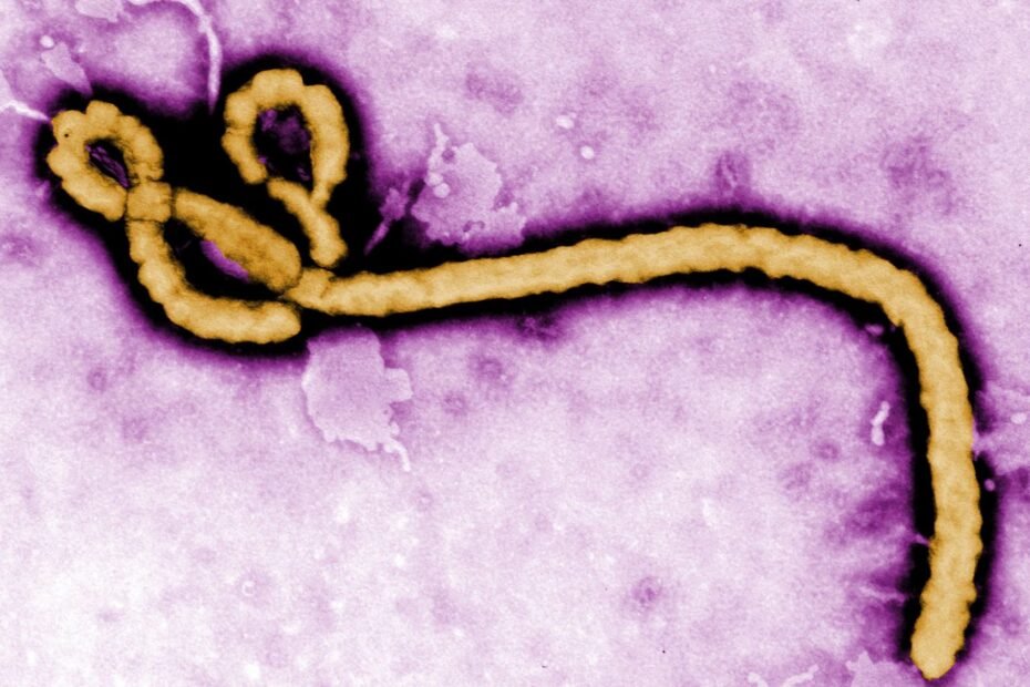 Ebola-Virus. Credits: CDC