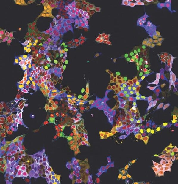 Fluoreszenzmikroskopiebild 1 von vpCell-Pools | Copyright: © Andreas Reicher |