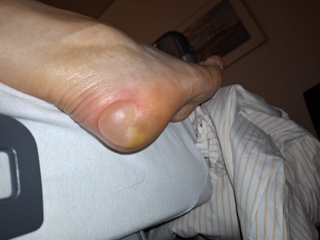 Helios Endo-Klinik Hamburg. Station 4. Etliche Patienten blieben von Donnerstag bis Montag ohne ärztliche Visite. Selbst lebensbedrohliche Zusammenbrüche mit Atemnot ließen keinen Arzt erscheinen. Credits: LabNews Media LLC