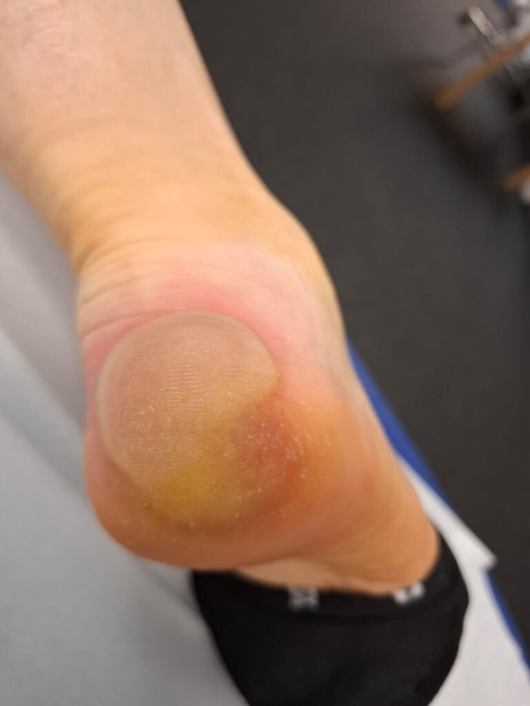 Helios Endo Klinik Hamburg: 48 Stunden nach der OP keine Visite auf der gesamten Station. Trotz Komplikationen werden Patienten einfach in die Reha abgeschoben. Realer Fall. Credits: LabNews Media LLC.