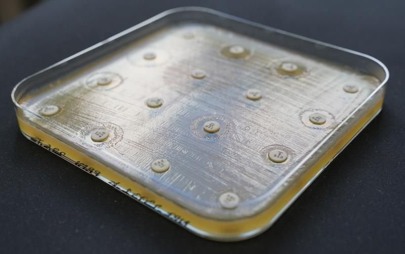 Treffen Antibiotikaplättchen auf eine Bakterienkultur, entstehen Hemmzonen, in denen das Bakterienwa ...
Quelle: Axel Hamprecht
Copyright: Universität Oldenburg / Axel Hamprecht